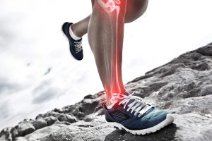 Infortuni legati alla corsa Parte 4: lesioni muscolari e sindrome da stress tibiale